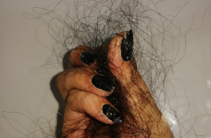 The Science of Hair Loss